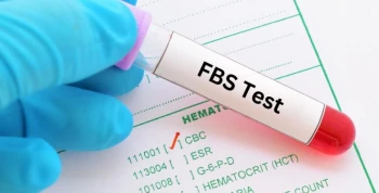 آزمایش Fasting Blood Sugar چیست؟